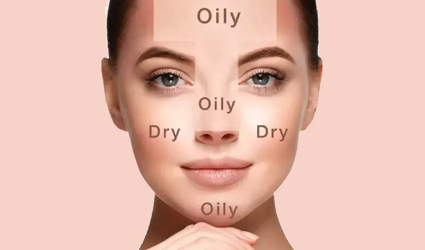 What is Combination Skin