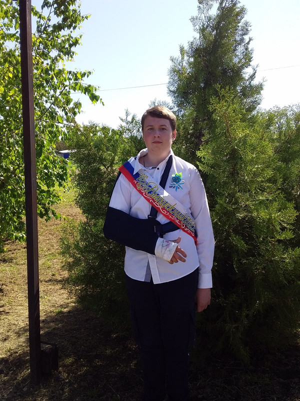 выпускник с рукой