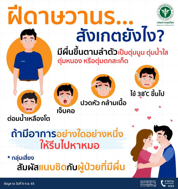 ฝีดาษวานรสังเกตยังไง? หากมีอาการอย่างใดอย่างหนึ่งต่อไปนี้ให้รีบไปหาหมอ