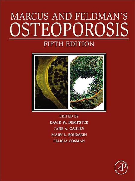 Marcus And Feldman’s Osteoporosis 5th Edition (David W. Dempster, Jane A. Cauley, Mary L. Bouxsein, Felicia Cosman) Marcus And Feldman’s Osteoporosis 5th Edition (David W. Dempster, Jane A. Cauley, Mary L. Bouxsein, Felicia Cosman)