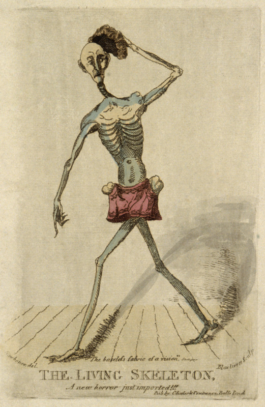 Claude_Ambroise_Seurat,_a_very_thin_man._Colour_etching._Wellcome_V0007227ER