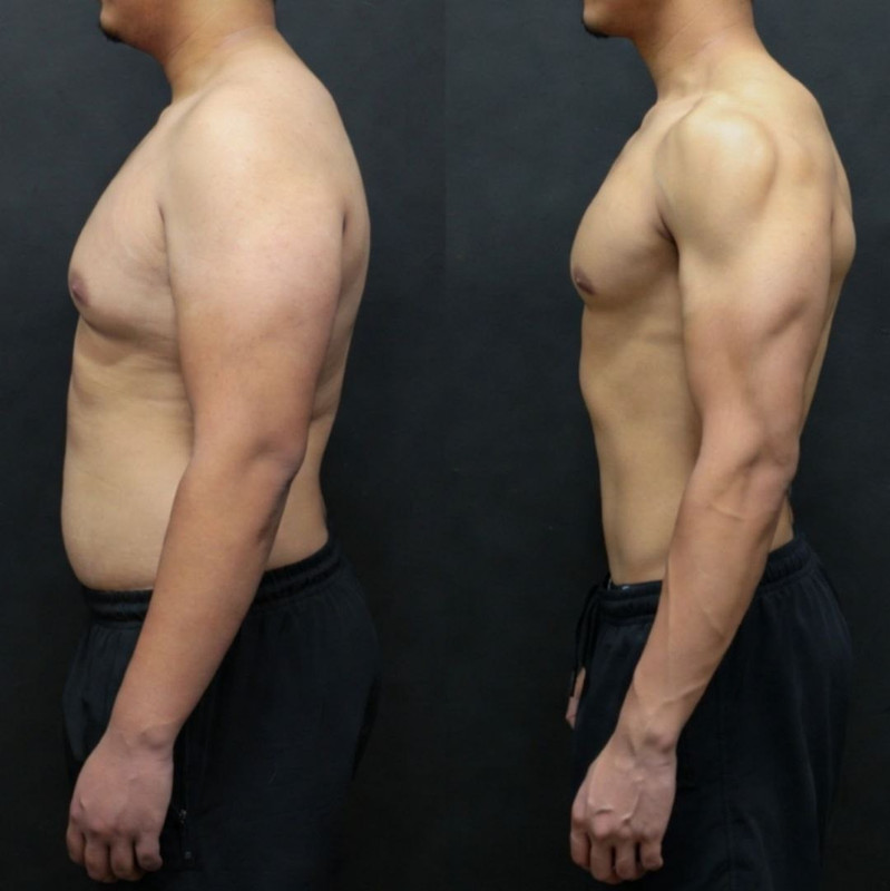 Клиент До и После 3