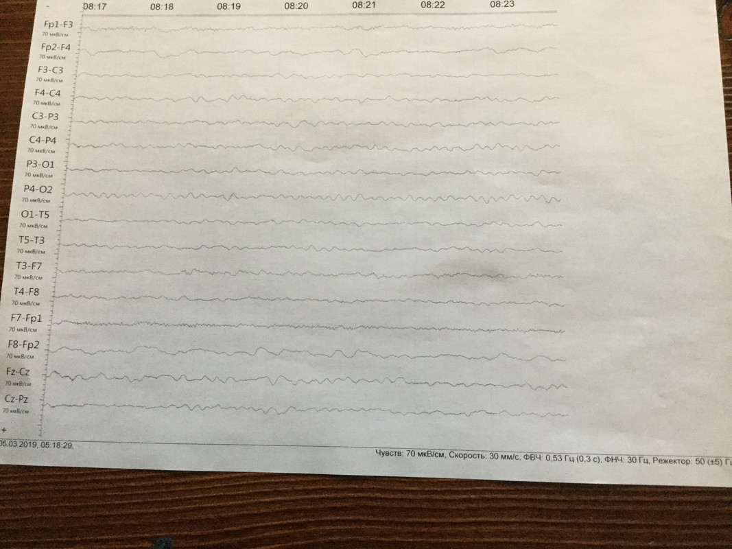 98A98844-5D72-4463-A30C-A8D0EB72690A