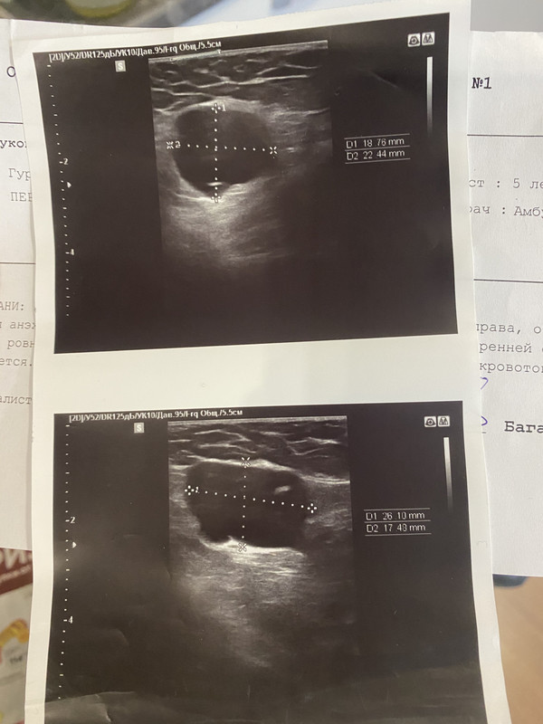 D2746C5C-AF7B-4110-98A6-974066FE9096