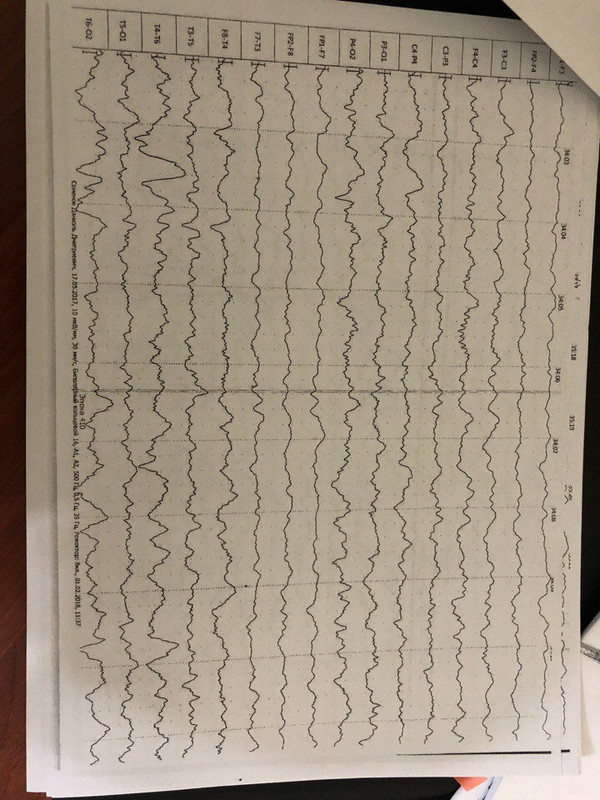 730B4ED6-BD0A-4A2E-B64D-8D63FF35B326