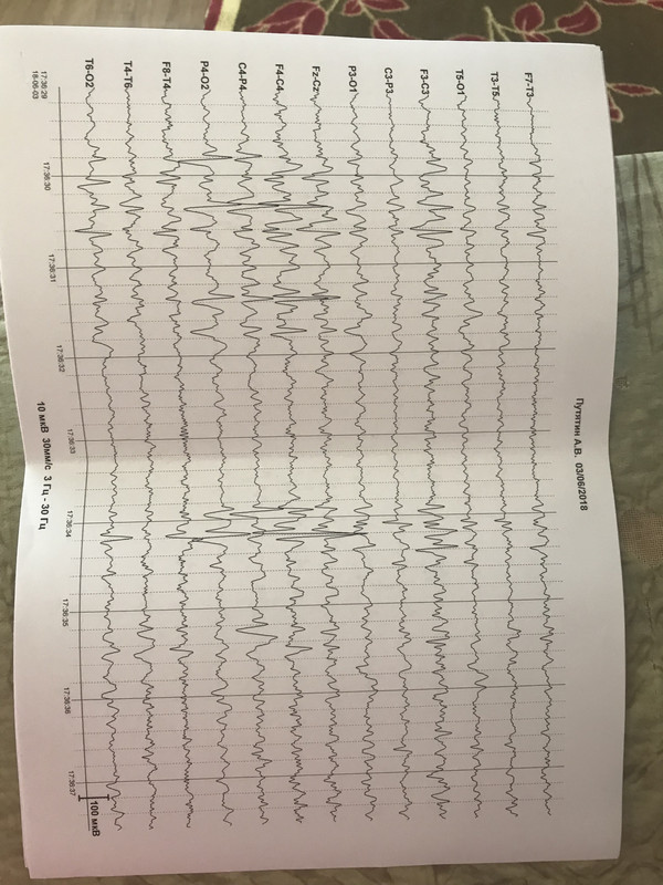 9C63BD22-AEB1-4070-A2E5-A37B5A2F1645