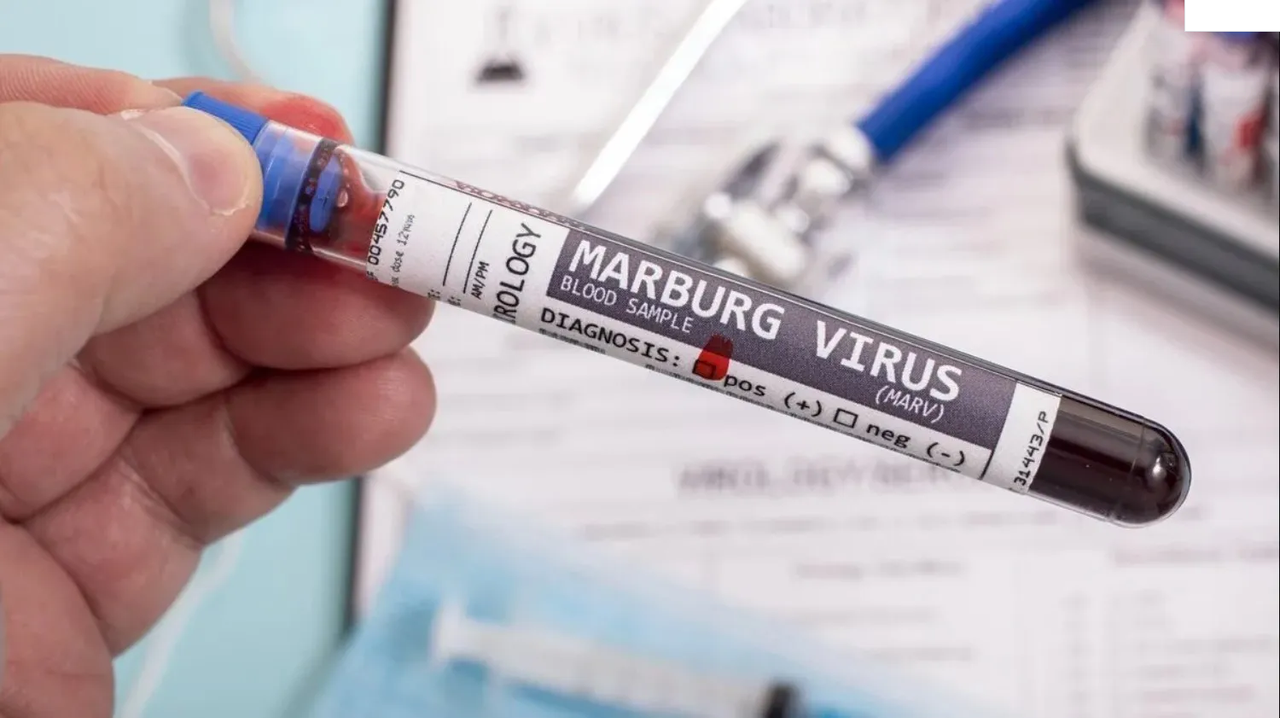 OMS analiza el brote de fiebre del virus de Marburgo