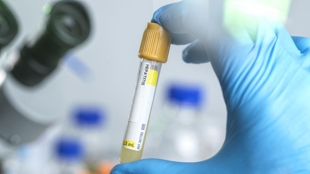 Hepatitis infantil de origen desconocido, un tema muy grave, asegura la OMS