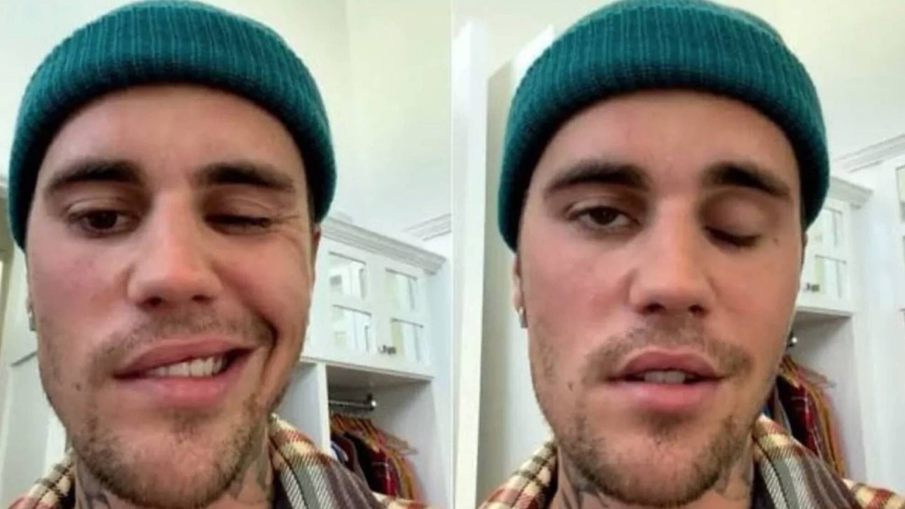Justin Bieber muestra señales de recuperación, tras su parálisis facial