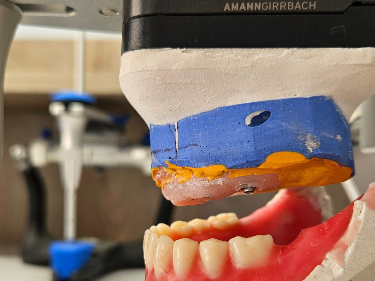 Montare în articulator Amann Girrbach - Roman Vlas