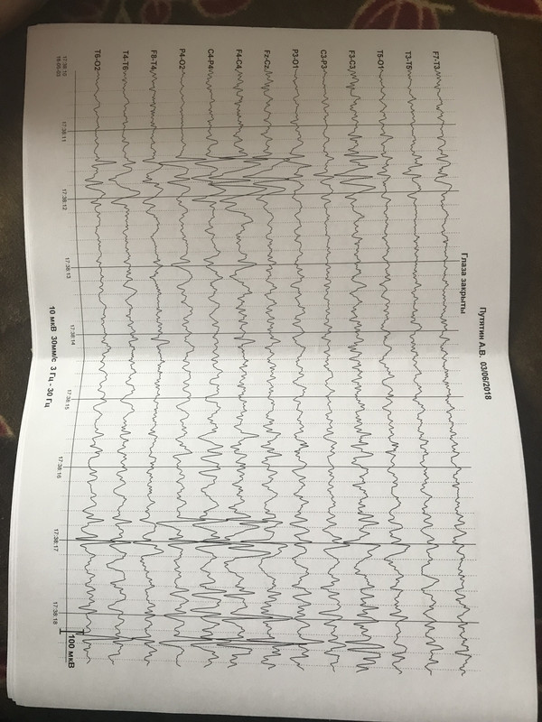 ADCC8140-8978-4100-8FB3-C9E7332101C0