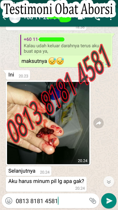 Testimoni Obat Aborsi 3
