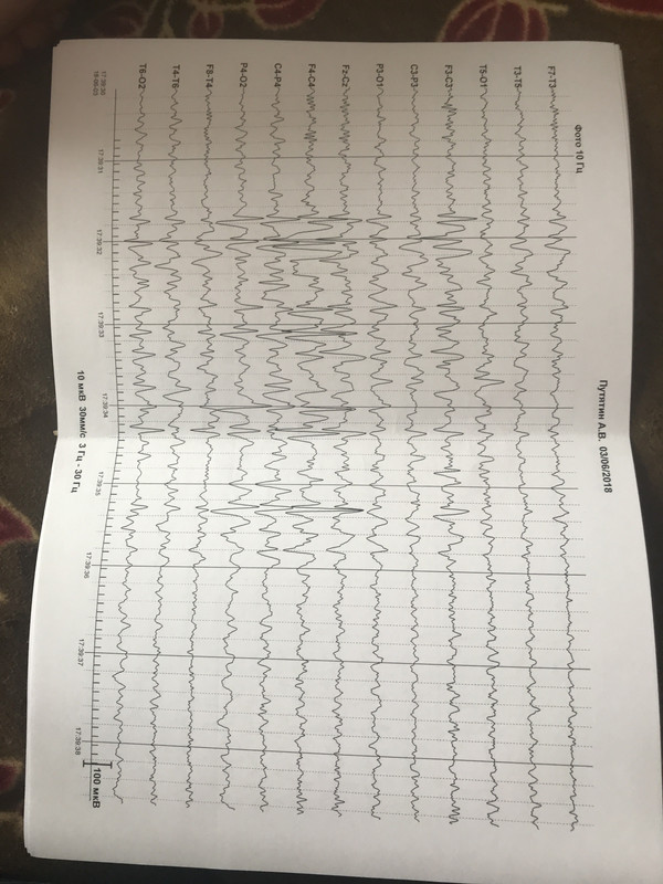 F884DDE4-C403-438F-9346-7107DA00B622