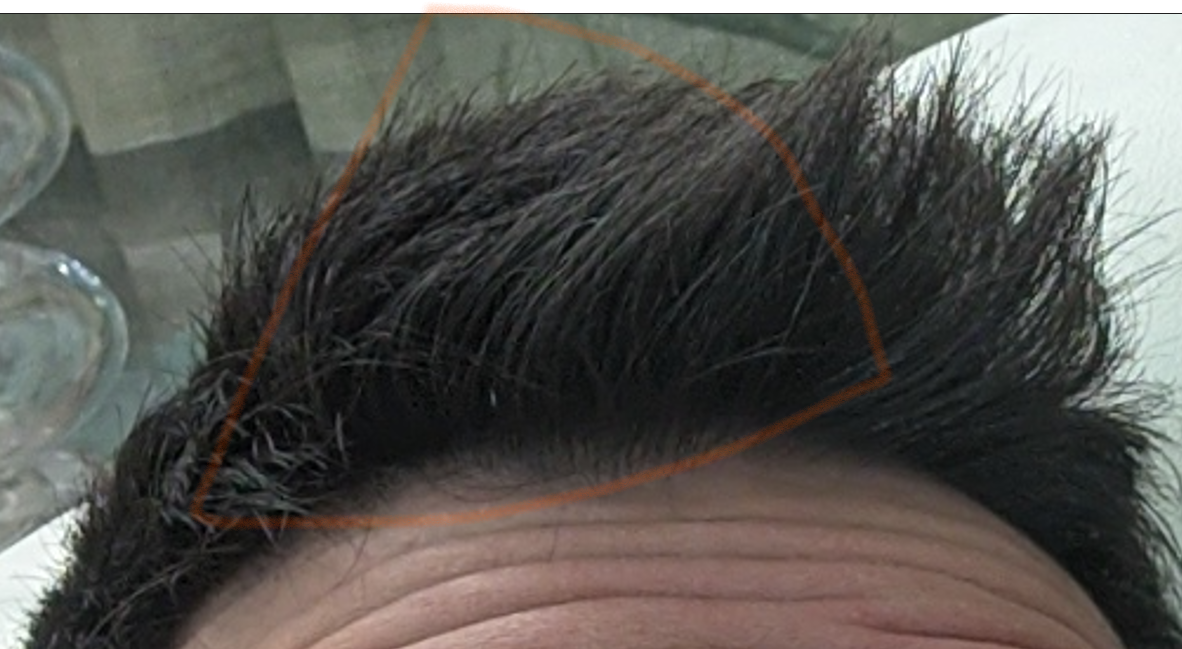 13. dicembre 2020. Capello tagliato. Zona cerchiata per fare capire che potevo tenerli sparati che a