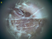 23207 177217 Into CNS 000010