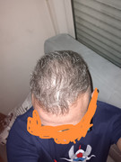 pelo24