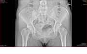 medenica.png