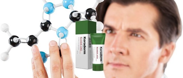 Keraderm crema para la psoriasis