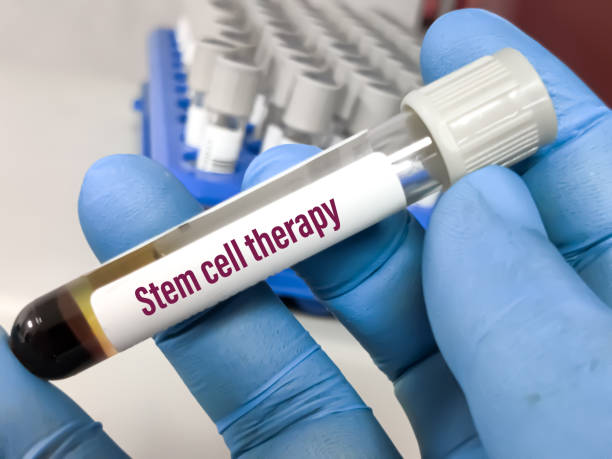 stem cell therapy in Mexico