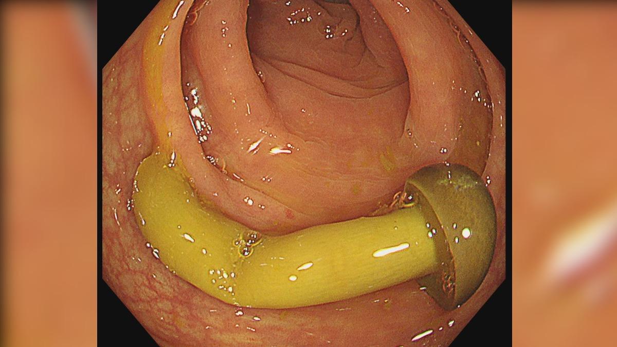 20250522134052-6e6b9a8e