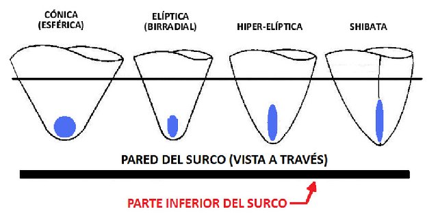 DIFERENCIA EN AGUJAS Agujas