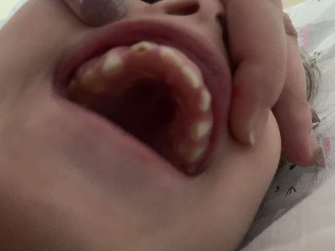 7222DD28-7DEE-4277-9983-64E6FC8AC9FC