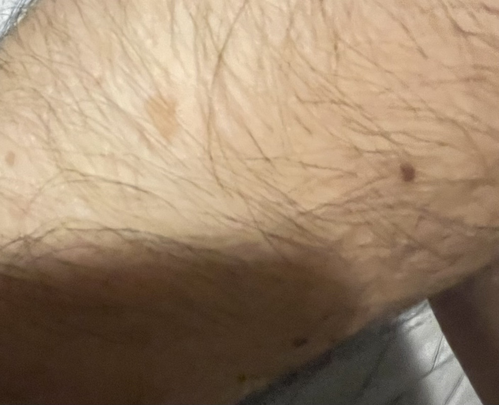 78ACA6AC-7A03-444D-A430-C8EA4D4413BD