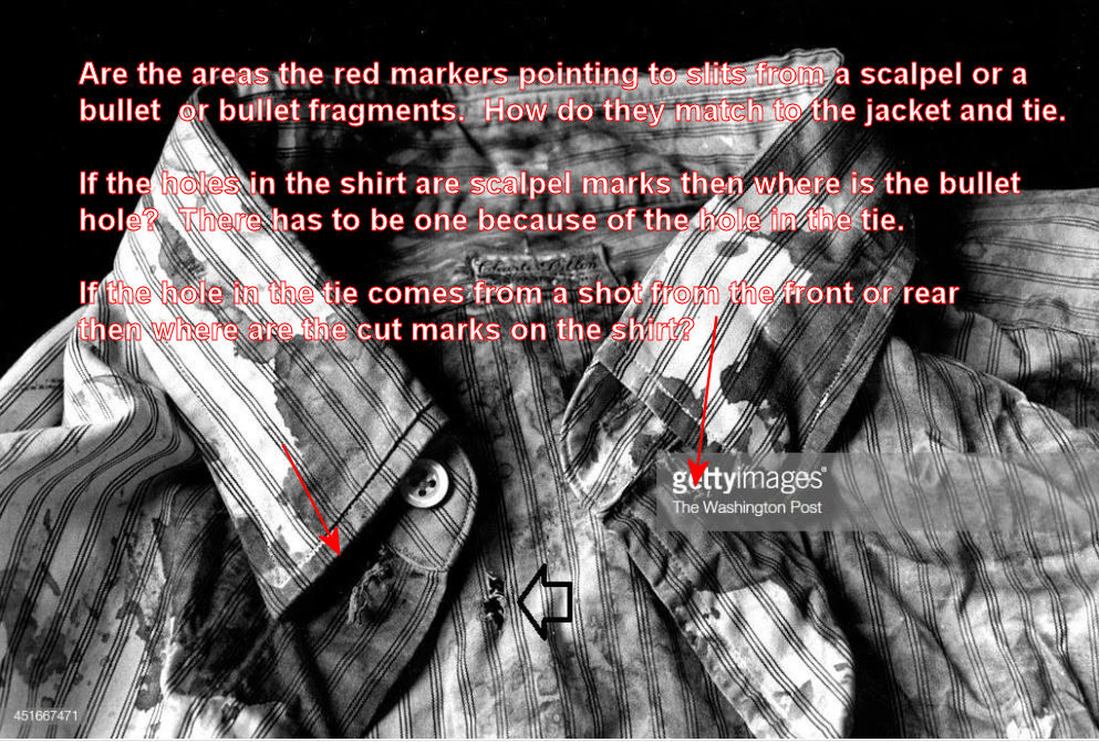 jfk-bloody-shirt-1.jpg