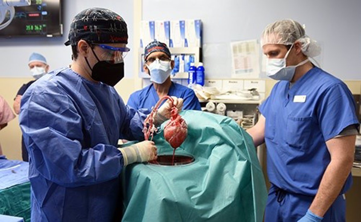 Paciente que recibió primer trasplante de corazón de cerdo murió por virus porcino