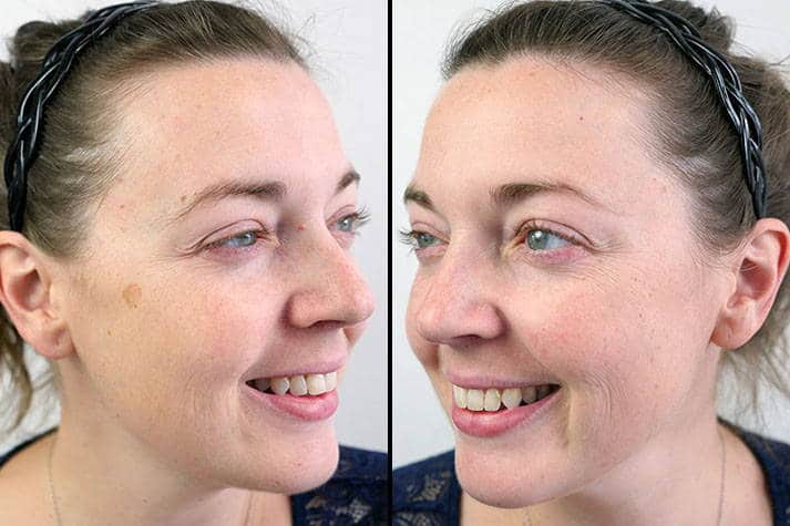 Proven Skincare Reviews