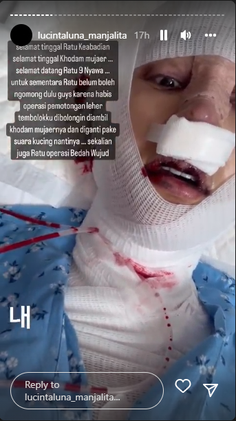 Lucinta Luna bagikan kondisi terkini pasca-operasi pemotongan leher 