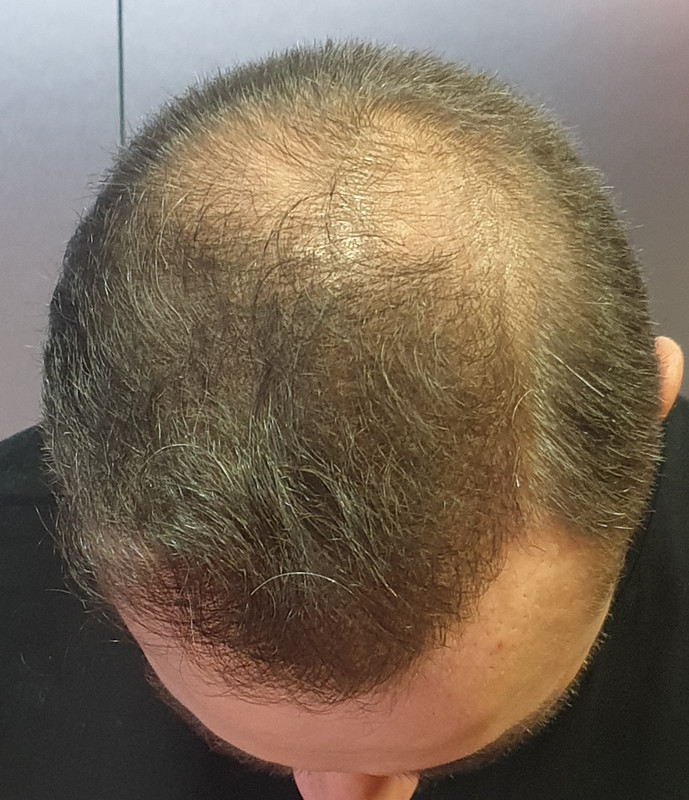 Point Blur_Dec082019_163816