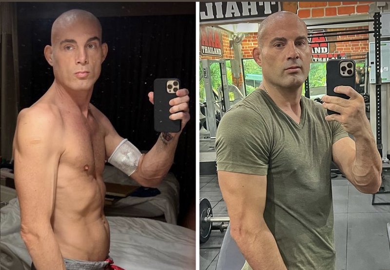 Бивш боец от UFC победи рак в стадий 4 за една година!