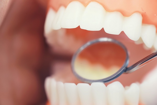Dental Check-Ups