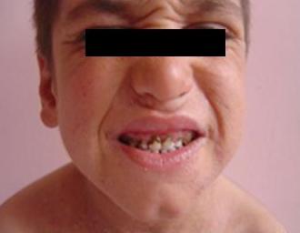 Pediatrics question 4 image