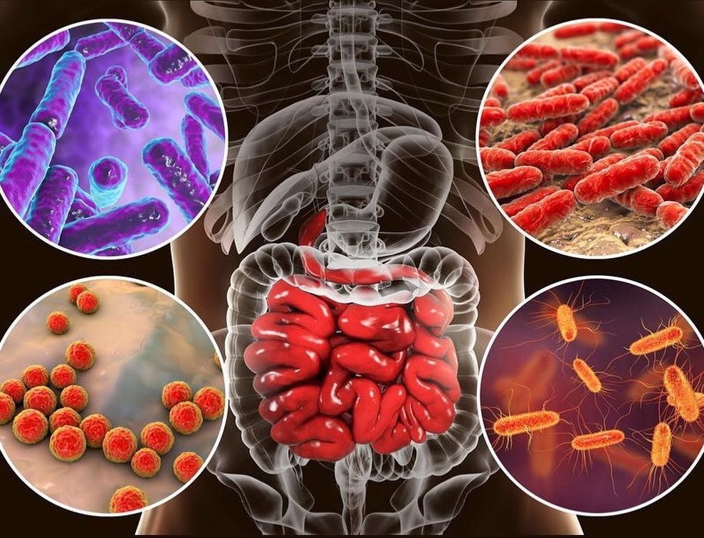 Ilustrasi usus dengan berbagai macam parasit dan virus