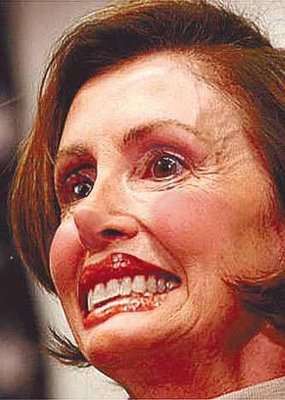 nancy_pelosi_botox_smile