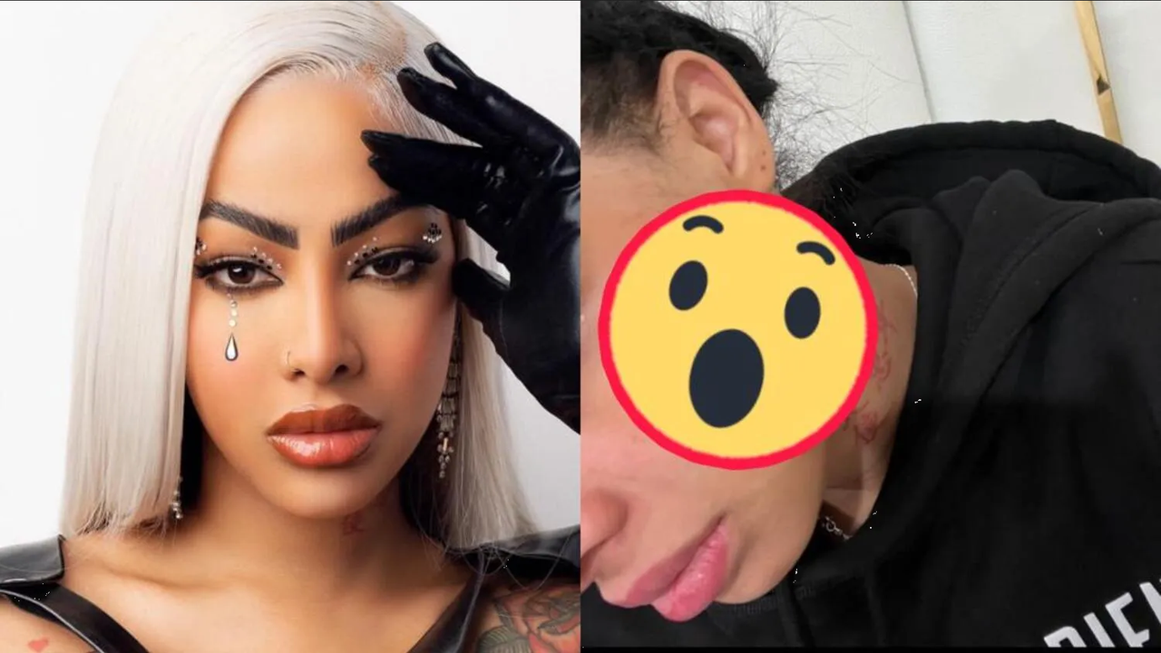 Yailin La Más Viral revela los golpes que Anuel AA le habría dado en una foto