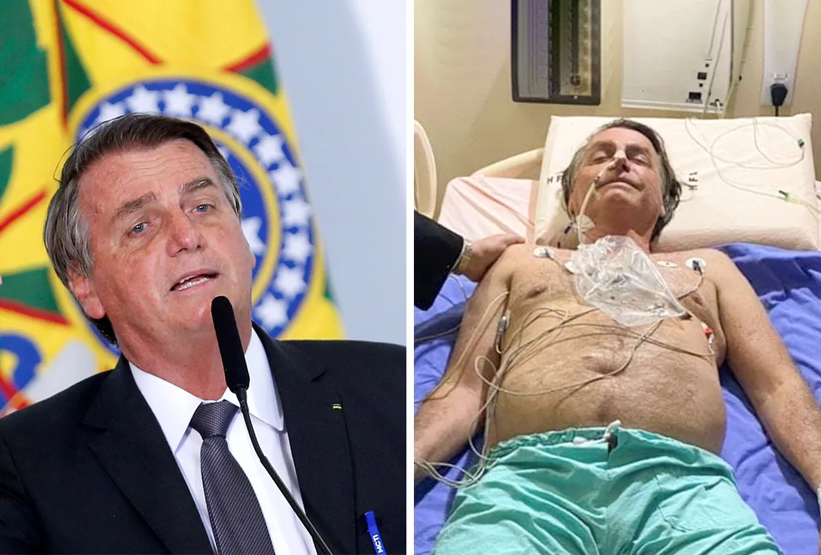 ¿Qué es la Erisipela? enfermedad que padece Jair Bolsonaro