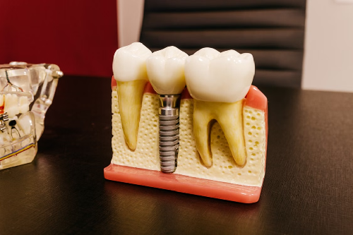 Dental-Implant-Professionals