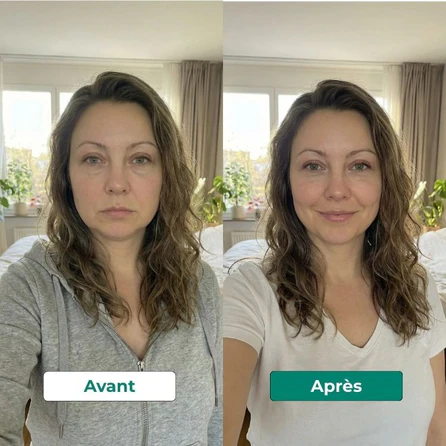 Résultat cliente Ylesia