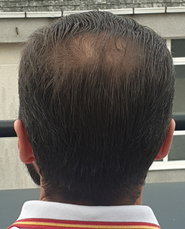 Point Blur_Apr132020_194521