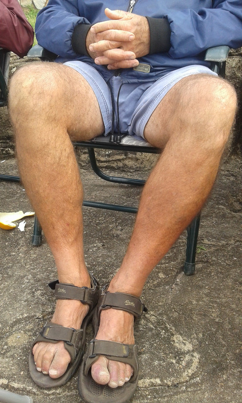 hairy-legs.jpg