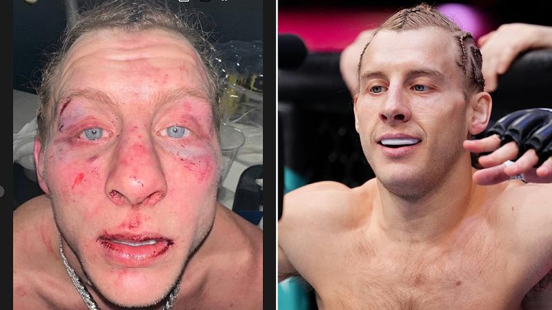 Пади Пимблет показа желязна брадичка