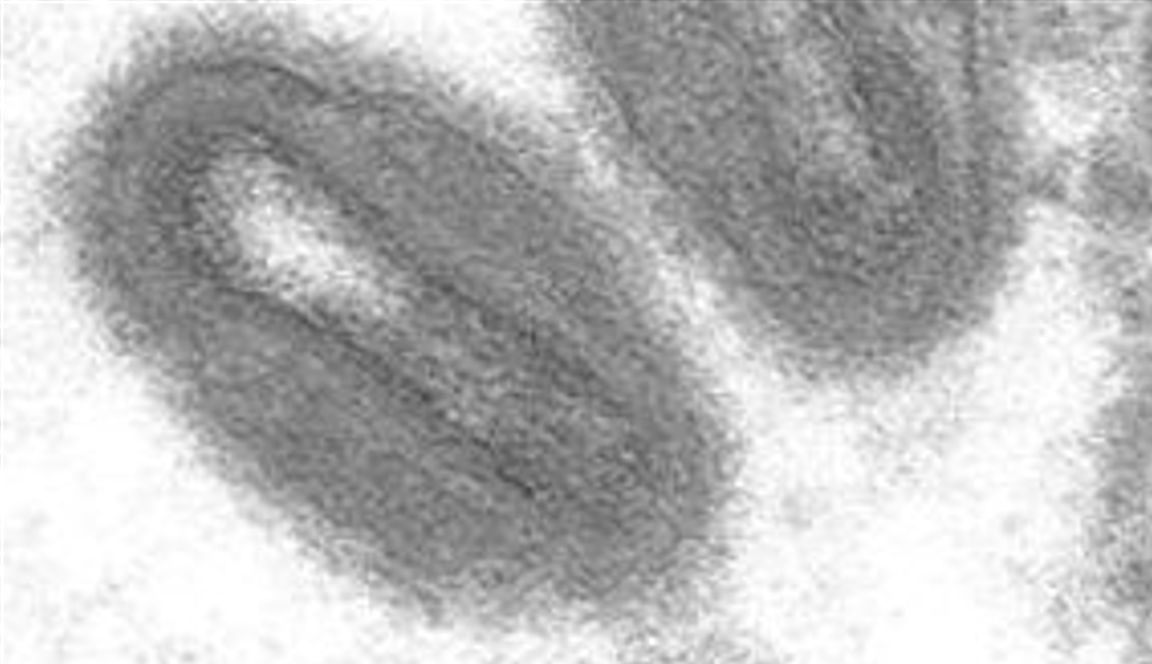 Estados Unidos confirma primer caso de viruela del mono