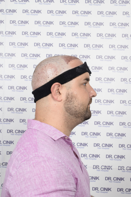 photos postopératoires (7)