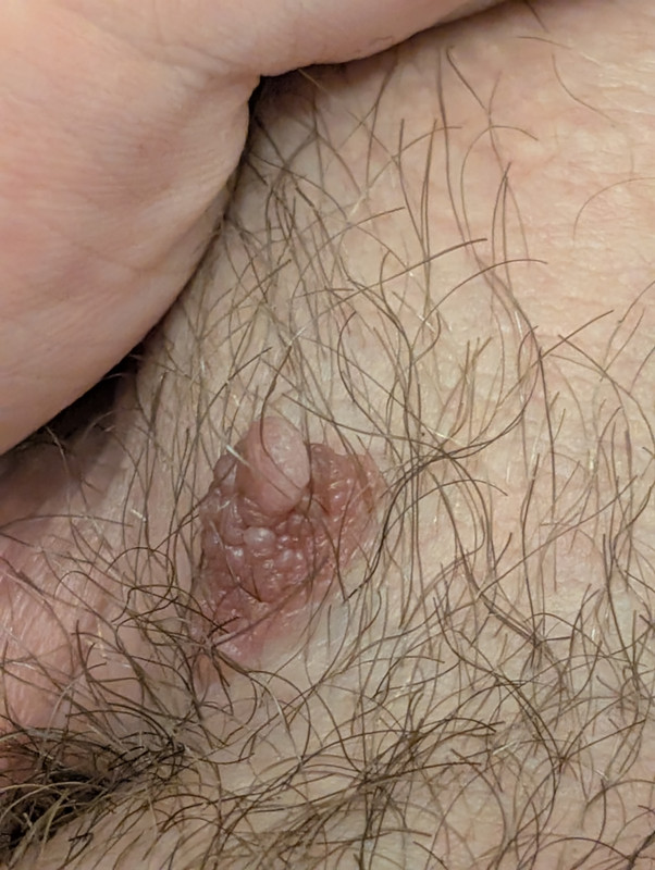 PXL 20251221 084630415