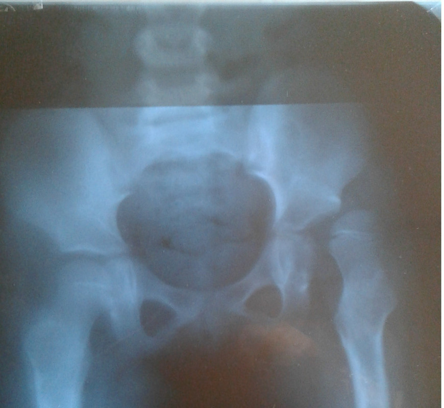 снимок 2018г тбс