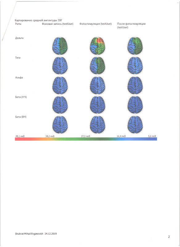 ЭЭГ 24.12.19 2.jpeg