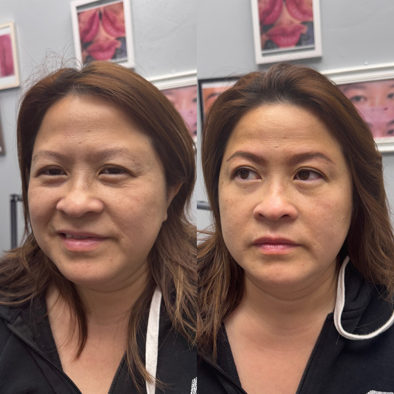Eyebrow Enhancement Example New 6